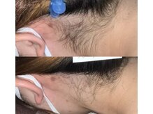 プリマ(Prima)/BEFORE&AFTER