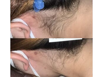 プリマ(Prima)/BEFORE&AFTER