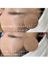 ナナイロサロン ニコリー(NaNairo nicolly)/【顔ワックス×光脱毛】