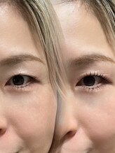 インク(ink)/隠れまつ毛にlushlift