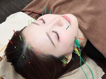 いおり鍼灸接骨院/美容鍼