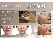 トロワ(TROIS)の雰囲気（結果重視☆専門知識を有するスタッフの信頼の施術！長野市/小顔）