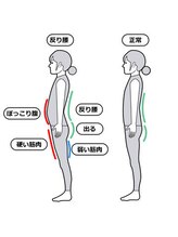 ナチュラル整体院/腰痛/反り腰/姿勢改善