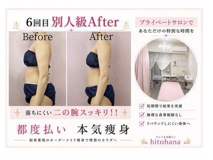 ヒトハナ(hitohana)の写真