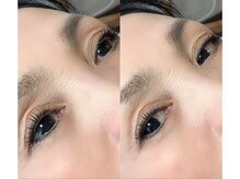 ラウレア(laule'a)/シングルラッシュ140本