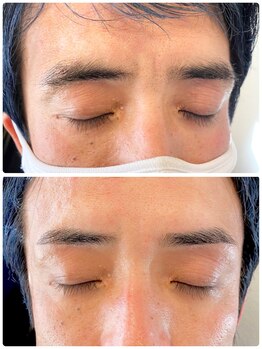 アイビー 人形町店(i.b)/眉【before⇒after】８９