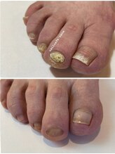 ネイルカフェ ナナ(nailcafe'nana)/足の爪にお悩みの方