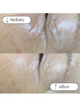 トータルビューティーサロンリア(Li'a)/ビフォー＆アフター