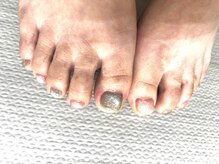 ラウレアネイル(laule'a nail)/フットネイル