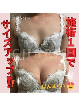 カリス(CHARIS)/アイリーン式1回の変化