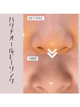 ザ エステティック福岡/バクチオール