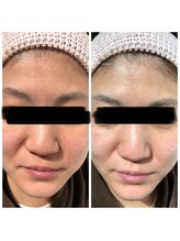 すっぴん美肌革命/顔全体が明るくなめらかに整う