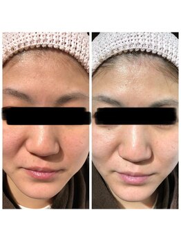 すっぴん美肌革命/顔全体が明るくなめらかに整う