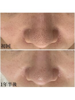 プラセル(Placer)/悩む未来or改善の未来