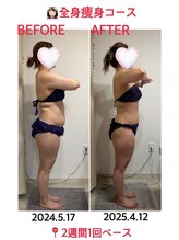 カトレア/★全身痩身★