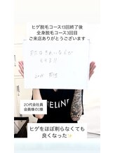 メンズビオ 神戸三宮店/