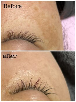 アスピリア(aspirer a')/白玉スノーピーリングで艶肌爆誕