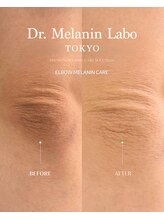 ドクターメラニン ラボ トーキョー 渋谷(Dr. Melanin Labo TOKYO)/AI診断でオーダーメイド施術