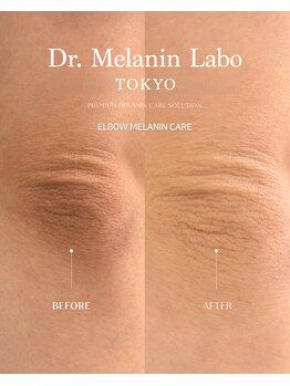ドクターメラニン ラボ トーキョー 渋谷(Dr. Melanin Labo TOKYO)/AI診断でオーダーメイド施術