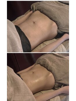 ヴァローレ(valore)/腸もみ