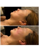 ビュウナ 銀座(BEAUNA)/マルチウェーブリフト