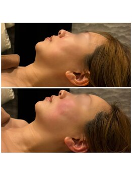 ビュウナ 銀座(BEAUNA)/マルチウェーブリフト