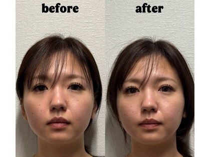 ベレディオ鍼灸整骨院(Belledio鍼灸整骨院)の写真