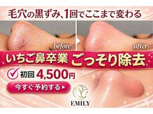 エミリー 守山(EMILY)