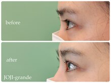 ジョージ グランデ(JO-JI grande)/根本からしっかりUP