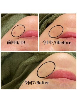 ラシック(Rachic)/クリスタルハーブパック