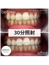 グリッター ショウナン(glitter. SHONAN)/老化での黄ばみも改善