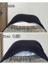 小顔22 ボルティ 本店(Bolty)/施術1回目