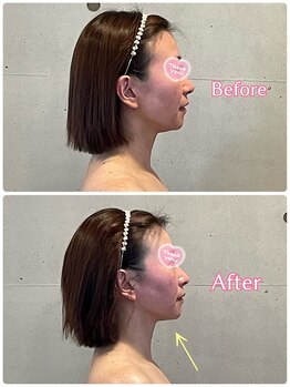 エクセレントビューティーサロン 艶(EN)/小顔　VENUSソニック