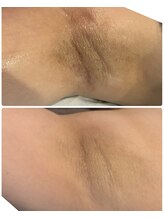 ミラトータルビューティ(Mira Total beauty)/