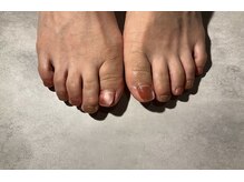 ヴァーチュープラス(VIRTUE PLUS)/