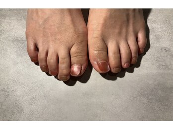 ヴァーチュープラス(VIRTUE PLUS)/