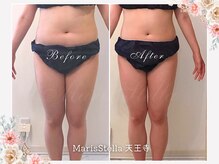 マリスステラ 天王寺(MarisStella)/腸マッサレッチでお腹すっきり！