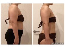 ボーテ(beaute)/【肋骨ケア】