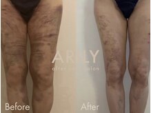アリリィ(ARILY)/ARILY after care salon