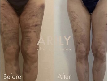 アリリィ(ARILY)/ARILY after care salon