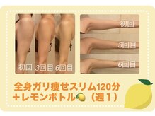 メルローズ 自由が丘店(Melrose)の雰囲気(話題の脂肪分解レモンボトル♪1アンプル10cc丸々導入!)