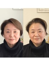 シェリーエトワール(Shelly Etoile)/ファシアマッサージ