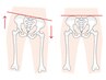 【♪産後ママさん☆応援キャンペーン♪】骨盤診断・骨盤矯正☆