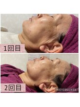 ビューティーサロン キャンディ 海老名(Candy)/