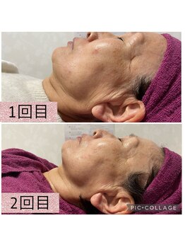 ビューティーサロン キャンディ 海老名(Candy)/