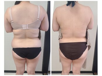 イベリス(IBERIS.)/当店ビフォーアフター