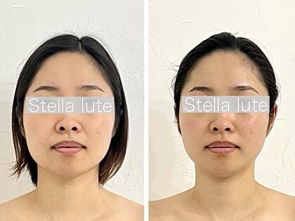 ステラルーテ(Stella lute)の写真