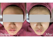 ハナ トータル ケア(Hana Total Care)/04仕上がり確認