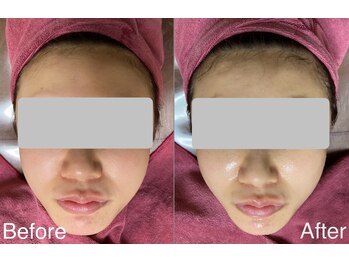 ハナ トータル ケア(Hana Total Care)/04仕上がり確認