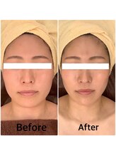 スペチアーレ 夙川/驚きの引き上がり